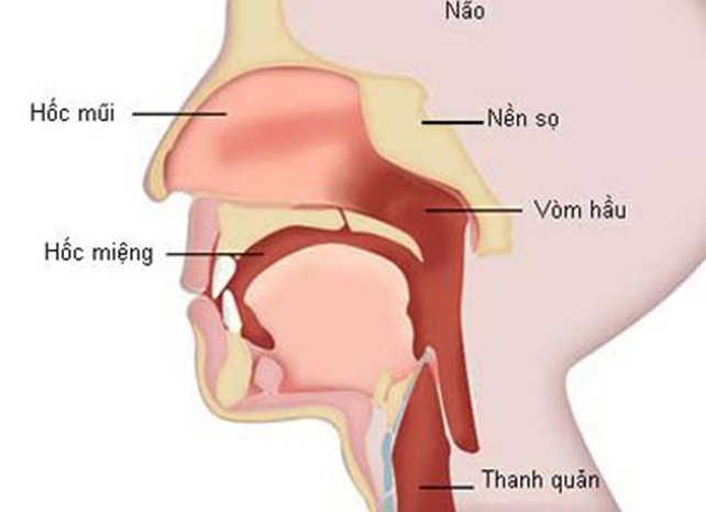 Triệu chứng của ung thư vòm họng