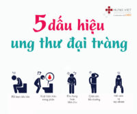 Làm thế nào phát hiện sớm ung thư đại tràng?