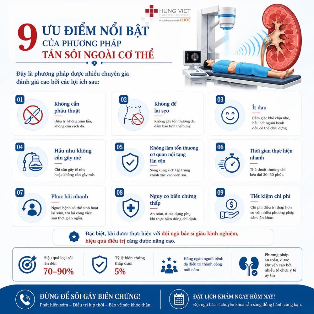 9 ưu điểm nổi bật của phương pháp tán sỏi ngoài cơ thể