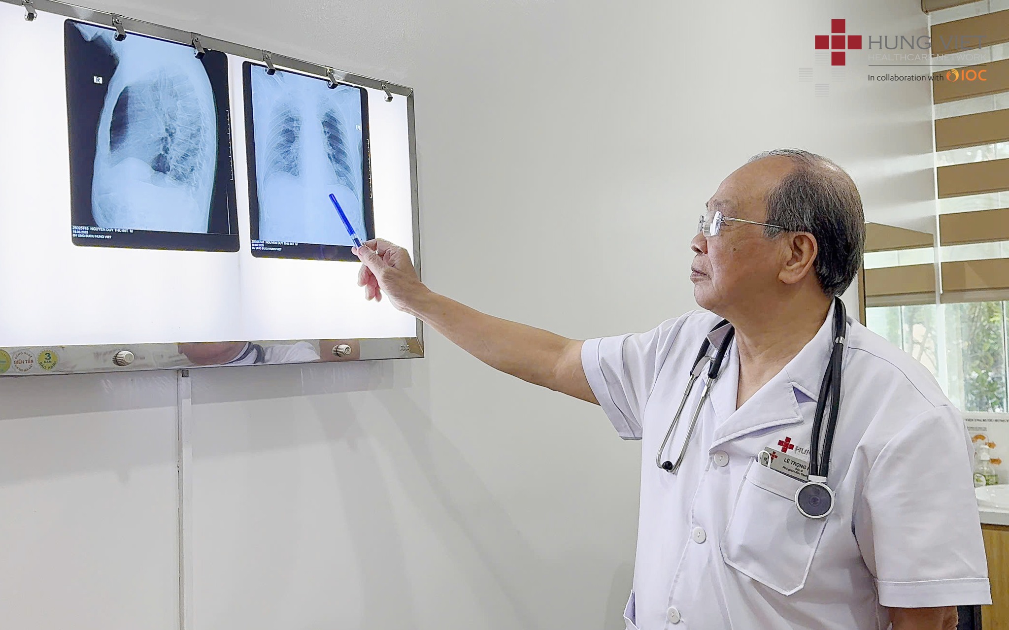 BS CKI Lê Trọng Hậu khám tầm soát ung thư phổi