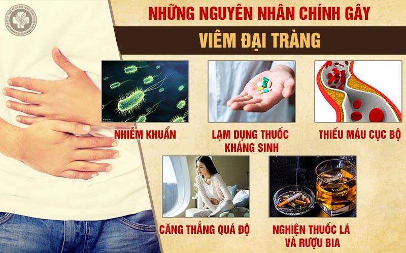 Nguyên nhân gây viêm đại tràng