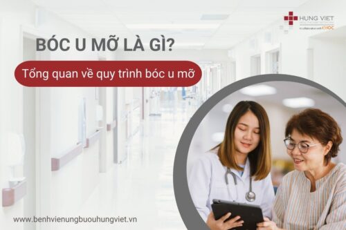 boc-u-mo-la-gi-tong-quan-ve-quy-trinh-boc-u-mo-01