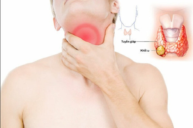 Kiểm tra sức khỏe định kỳ để phát hiện sớm các dấu hiệu của bệnh u tuyến giáp Kiểm tra sức khỏe định kỳ để phát hiện sớm các dấu hiệu của bệnh u tuyến giáp
