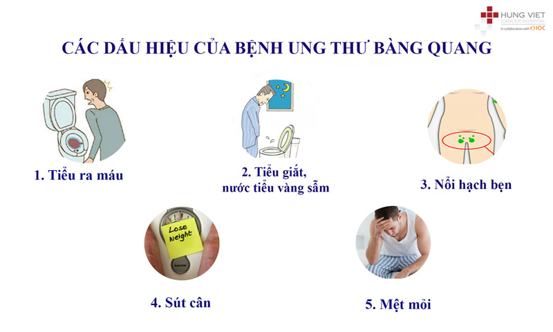 Dấu hiệu ung thư bàng quang