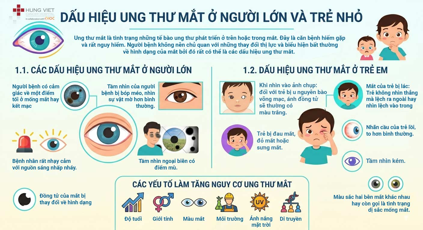 Dấu hiệu ung thư mắt ở người lớn và trẻ em