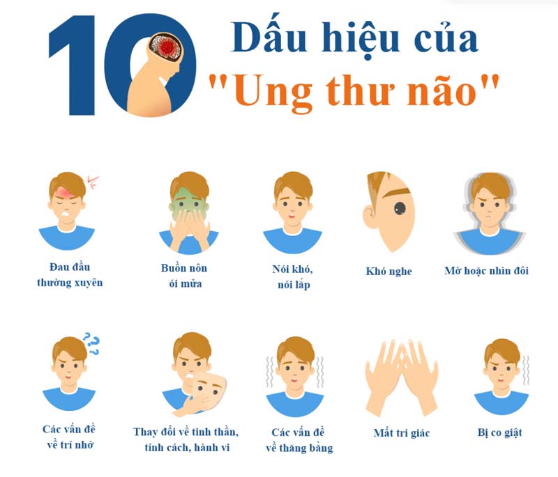 dấu hiệu ung thư não