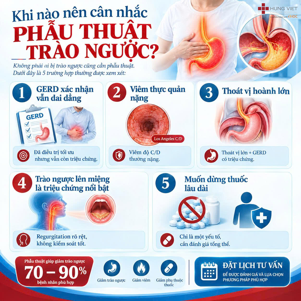Khi nào nên phẫu thuật trào ngược dạ dày