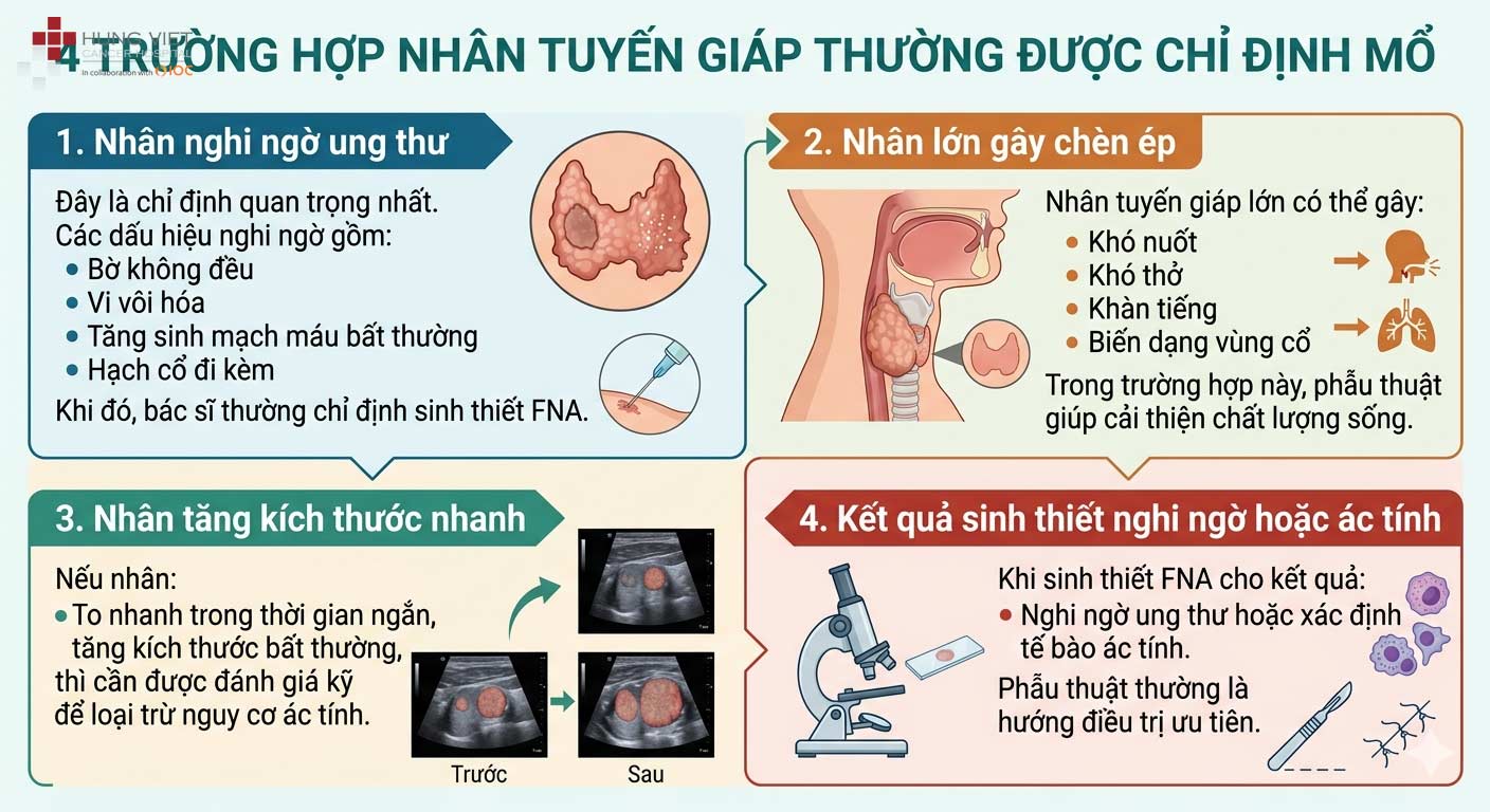 4 TRƯỜNG HỢP NHÂN TUYẾN GIÁP THƯỜNG ĐƯỢC CHỈ ĐỊNH MỔ