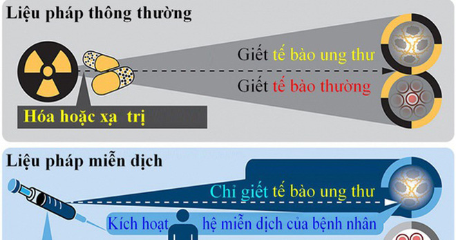 Liệu pháp miễn dịch khi điều trị ung thư đại tràng di căn gan