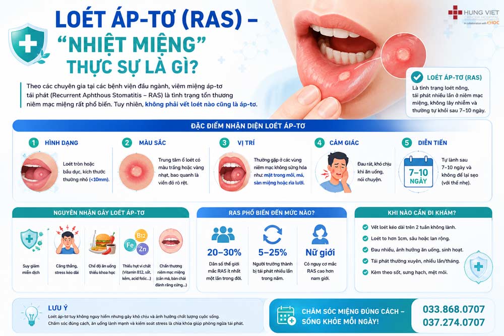 Loét miệng tái phát đừng “chủ quan là nhiệt miệng”