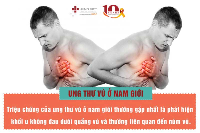 Dấu hiệu ung thư vú nam