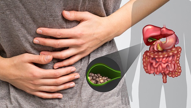 Nguyên nhân triệu chứng cách điều trị bệnh sỏi mật