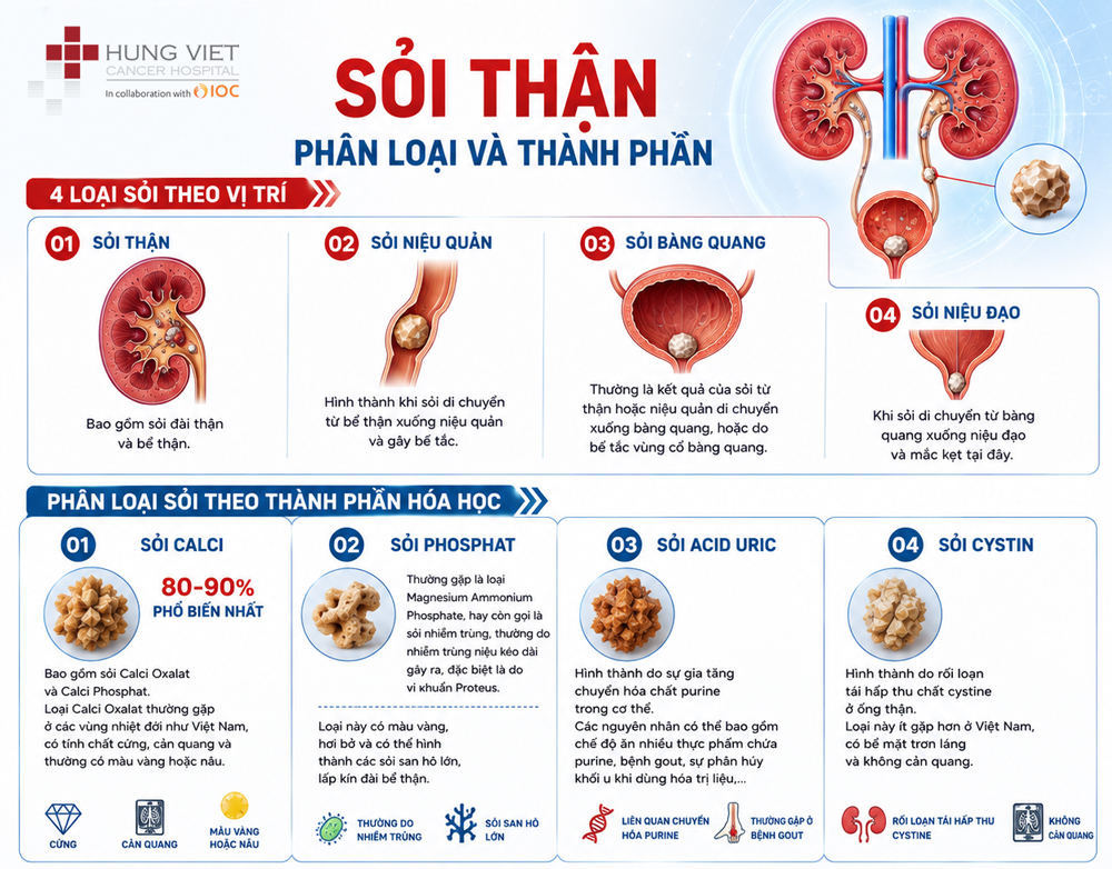 Phân loại sỏi thận