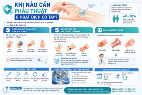 Phẫu thuật u hoạt dịch cổ tay – Khi nào bác sĩ chỉ định?