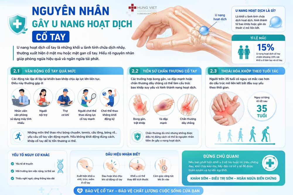 Phẫu thuật u hoạt dịch cổ tay – Khi nào bác sĩ chỉ định?