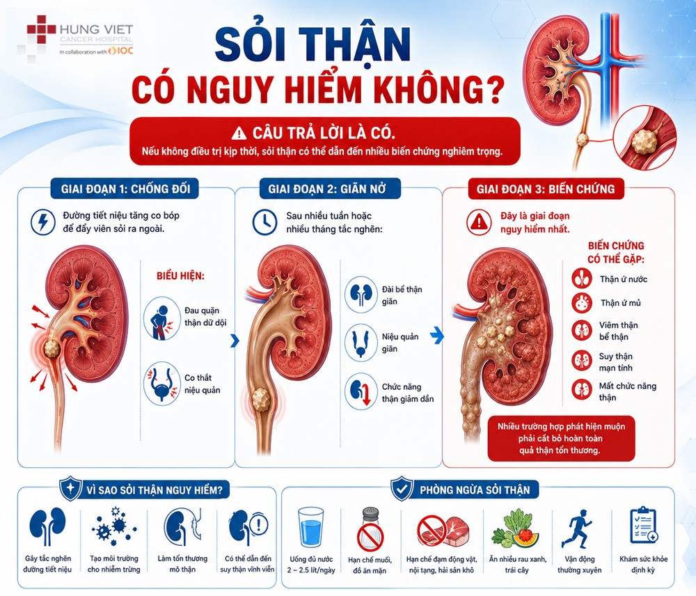 Sỏi thận có nguy hiểm không?