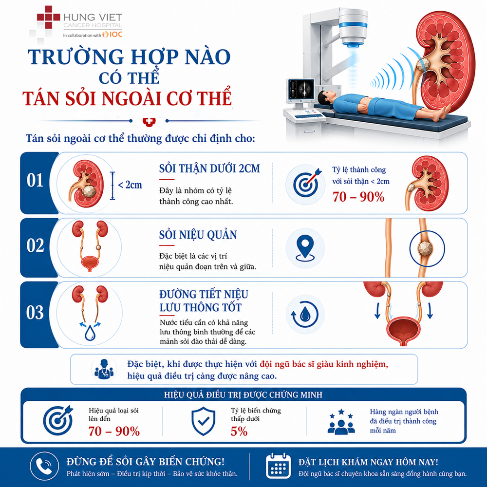 Tán sỏi ngoài cơ thể