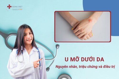 u-mo-duoi-da-tat-ca-nhung-gi-ban-can-biet-ve-nguyen-nhan-trieu-chung-va-dieu-tri-01