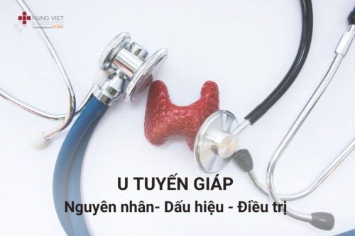 u-tuyen-giap-la-gi-nguyen-nhan-dau-hieu-va-cach-dieu-tri-benh-01