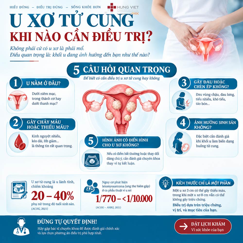 U xơ tử cung - khi nào cần điều trị