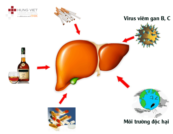 Ung thư gan có dự phòng được không? 7 cách giảm nguy cơ hiệu quả