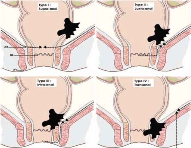 3. Triệu Chứng và Dấu Hiệu Nhận Biết