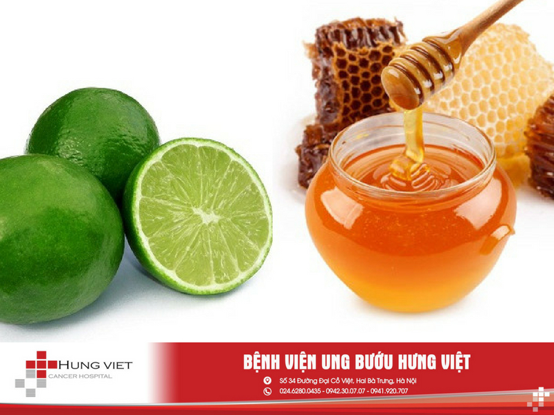 Chữa viêm amidan Chữa viêm amidan