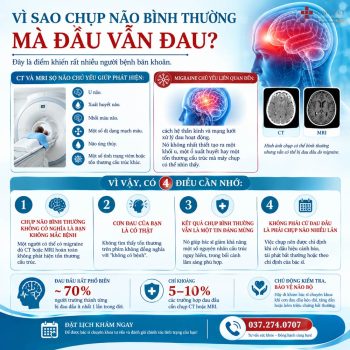 vì sao chụp não bình thường mà đầu vẫn đau