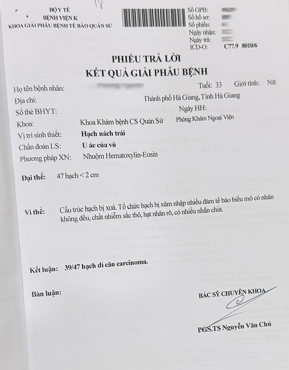 Vì sao nhiều người chọn xạ trị điều biến liều (IMRT) để xạ trị ung thư vú?