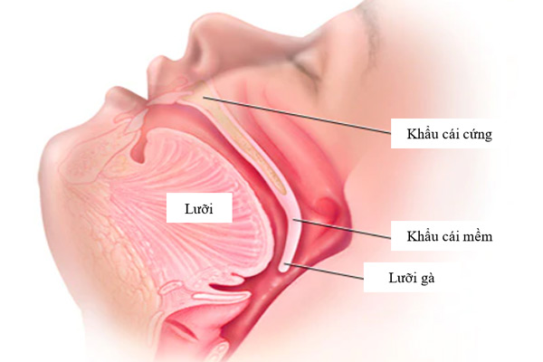 Tư vấn trường hợp] Viêm khẩu cái cứng