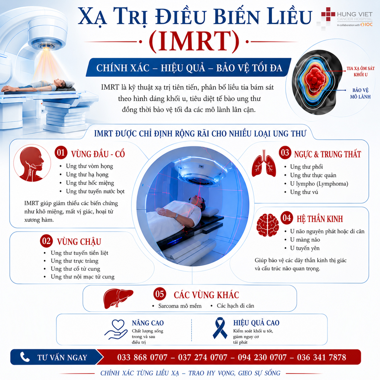 Xạ trị điều biến liều IMRT