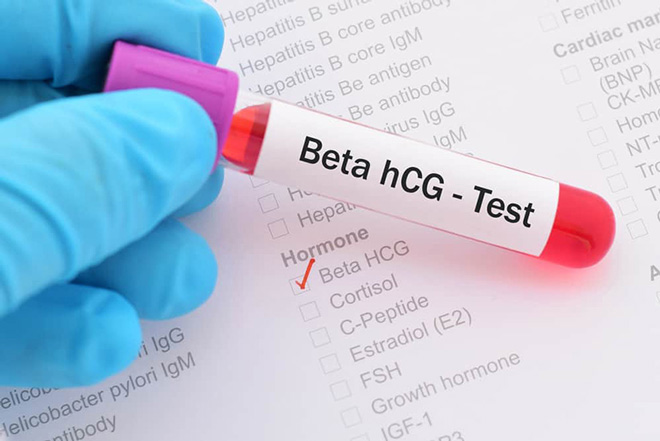 Xét nghiệm beta HCG bao nhiêu tiền