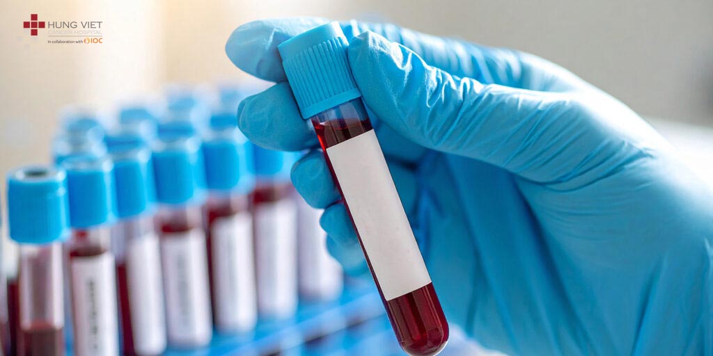 Xét nghiệm máu có phát hiện ung thư không