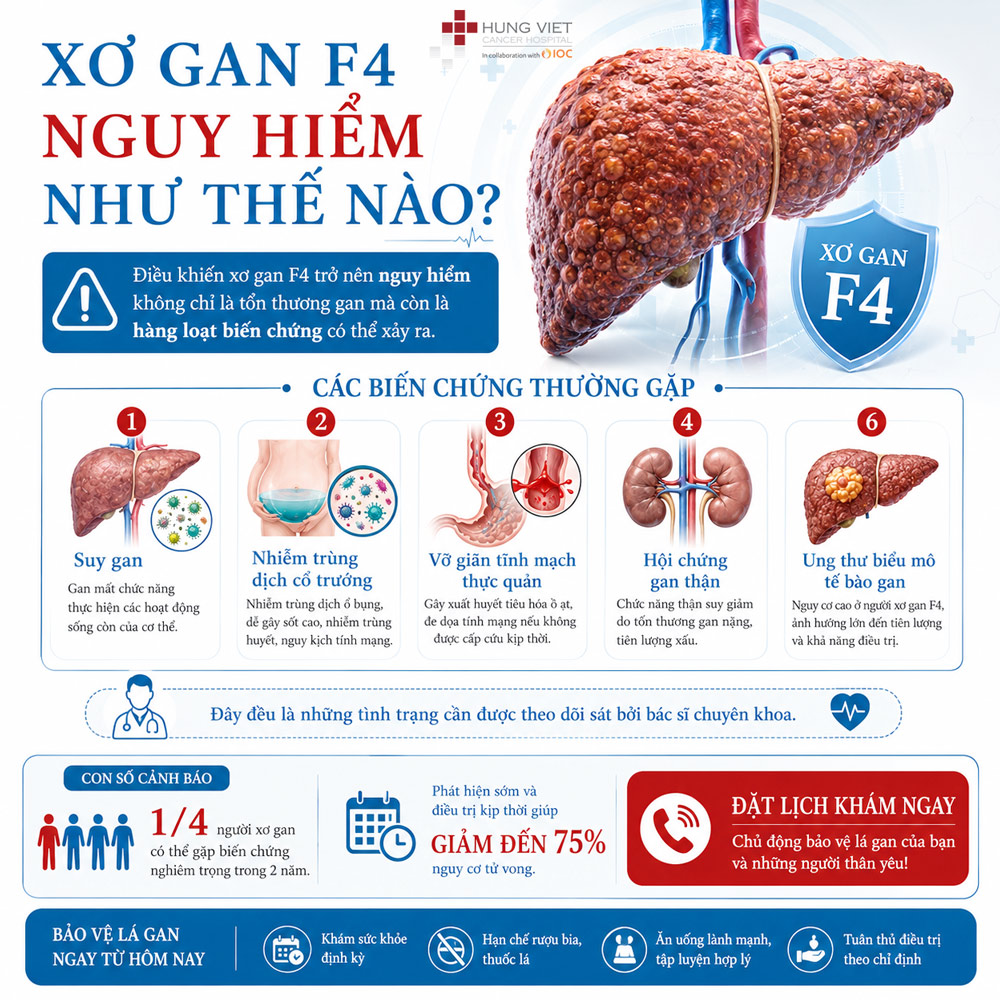 Xơ gan F4 - Xơ gan giai đoạn 4